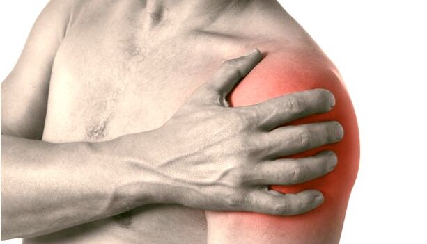 肩部肿胀、发红、肿大——2-3级肩关节关节炎的症状